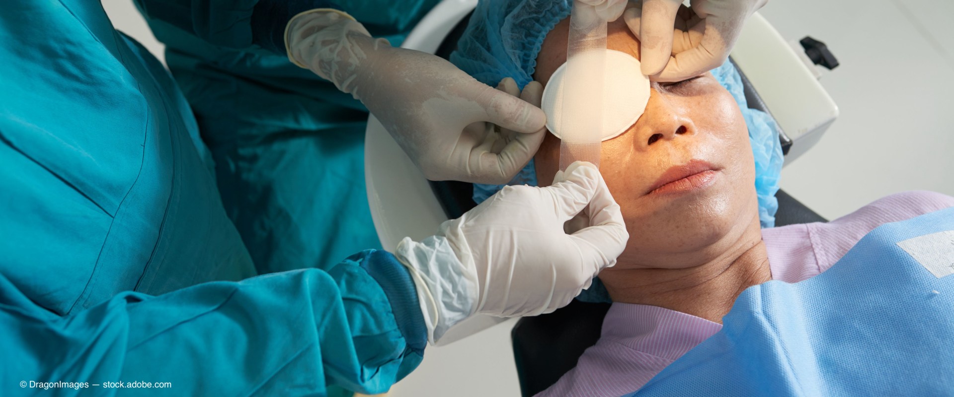 A Comprehensive Guide to a Quick Recovery After Cataract Surgery