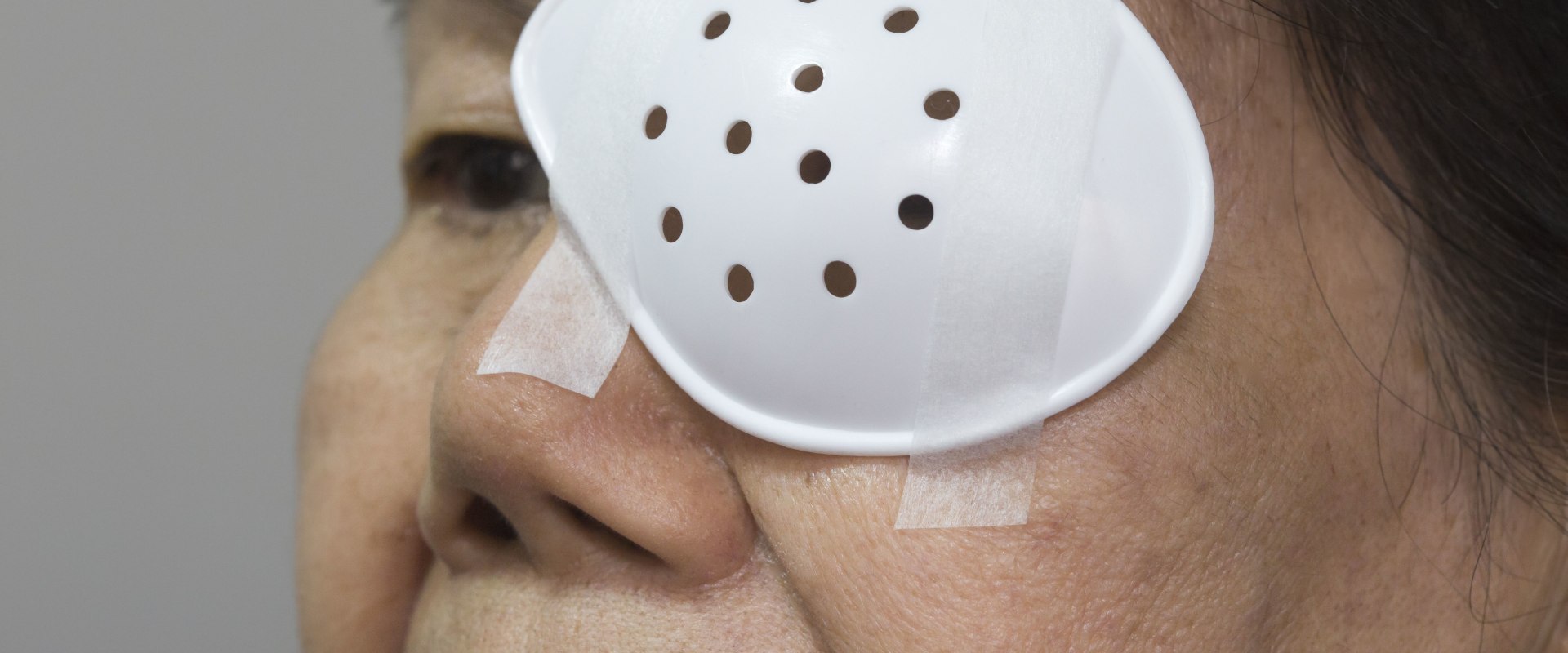 How Many Days of Rest is Needed After Cataract Surgery?