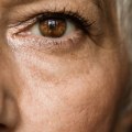 Will Vision Be the Same in Both Eyes After Cataract Surgery?