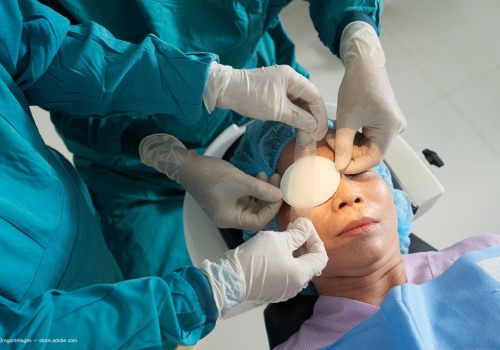 What to Monitor After Cataract Surgery: A Guide for Patients