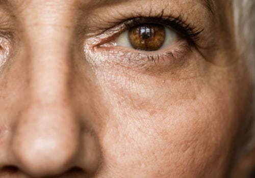 When is the Right Time to Undergo Cataract Surgery?