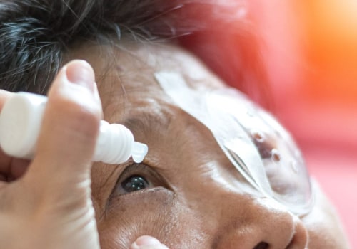 What are the Rules After Cataract Surgery?